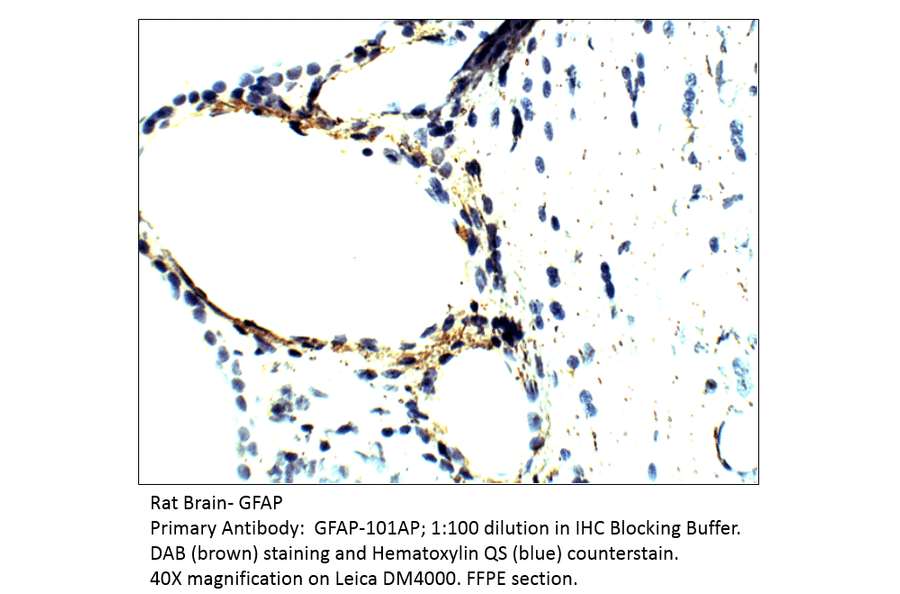 Anti-GFAP Antibody from FabGennix (GFAP-101AP) - Antibodies.com