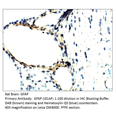 Anti-GFAP Antibody from FabGennix (GFAP-101AP) - Antibodies.com