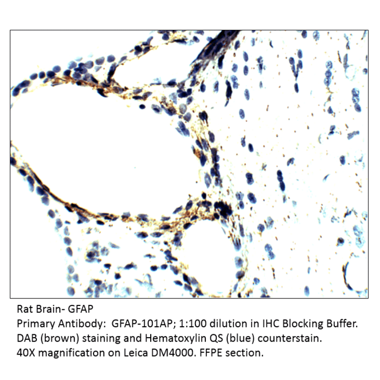 Anti-GFAP Antibody from FabGennix (GFAP-101AP) - Antibodies.com