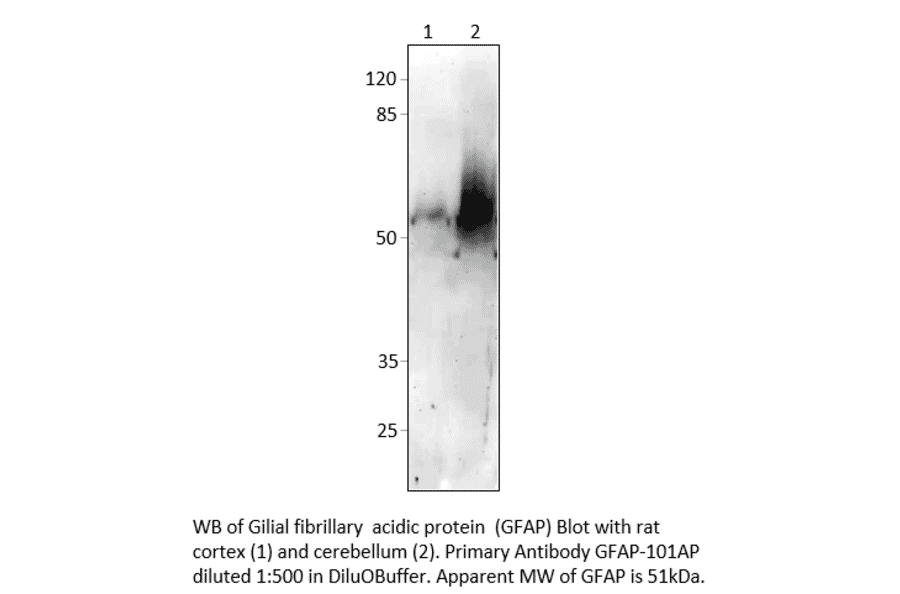 Anti-GFAP Antibody from FabGennix (GFAP-101AP) - Antibodies.com
