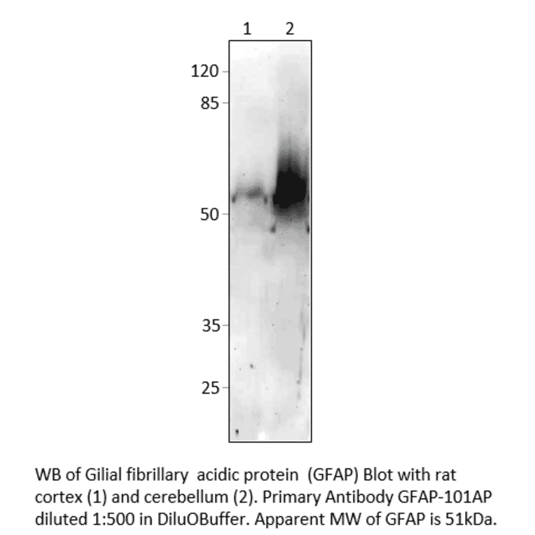 Anti-GFAP Antibody from FabGennix (GFAP-101AP) - Antibodies.com