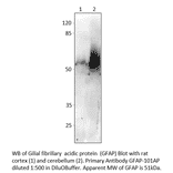 Anti-GFAP Antibody from FabGennix (GFAP-101AP) - Antibodies.com