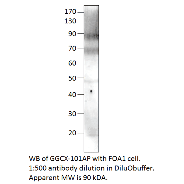 Anti-GGCX Antibody from FabGennix (GGCX-101AP) - Antibodies.com