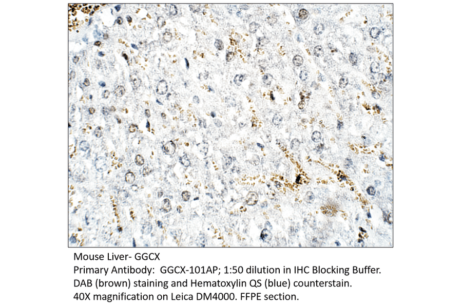 Anti-GGCX Antibody from FabGennix (GGCX-101AP) - Antibodies.com