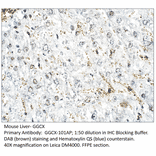 Anti-GGCX Antibody from FabGennix (GGCX-101AP) - Antibodies.com