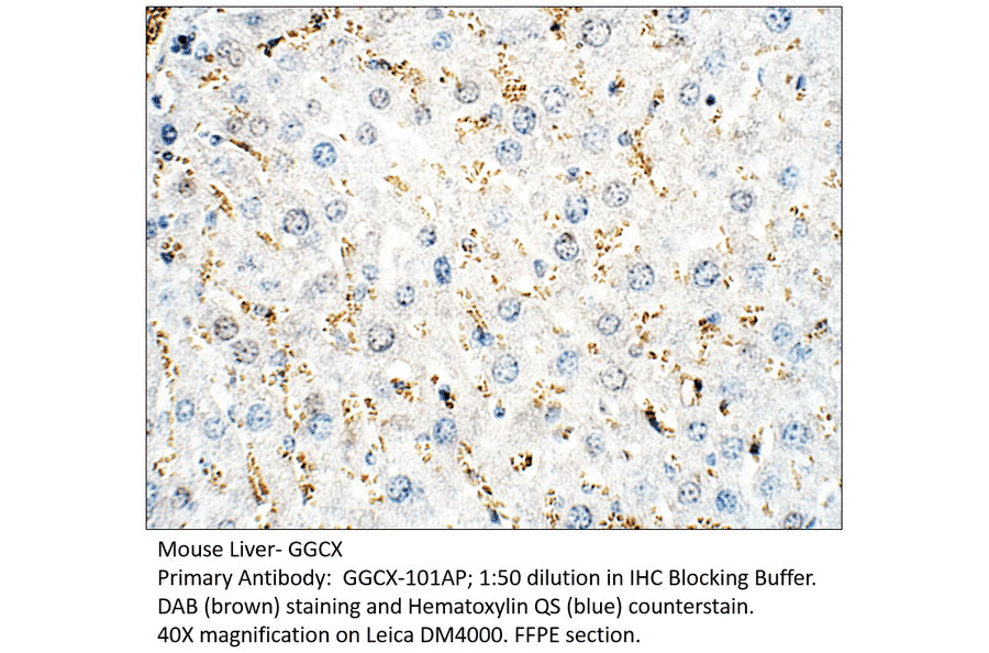 Anti-GGCX Antibody from FabGennix (GGCX-101AP) - Antibodies.com