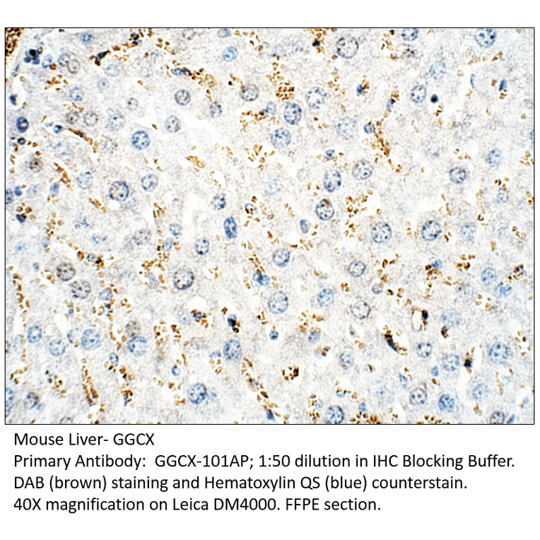 Anti-GGCX Antibody from FabGennix (GGCX-101AP) - Antibodies.com
