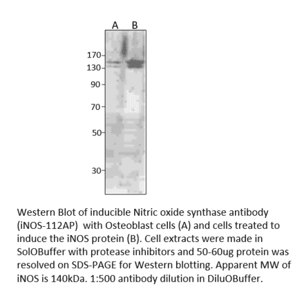 Anti-iNOS Antibody from FabGennix (iNOS-112AP) - Antibodies.com
