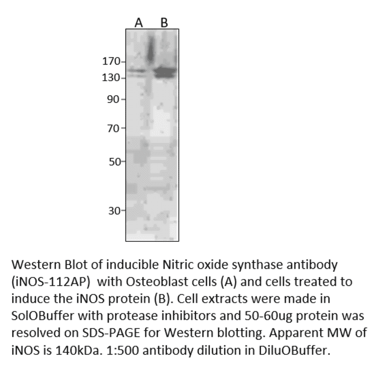 Anti-iNOS Antibody from FabGennix (iNOS-112AP) - Antibodies.com