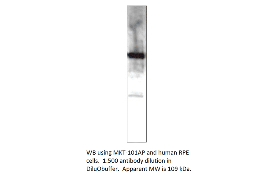 Anti-MERTK Antibody from FabGennix (MKT-101AP) - Antibodies.com