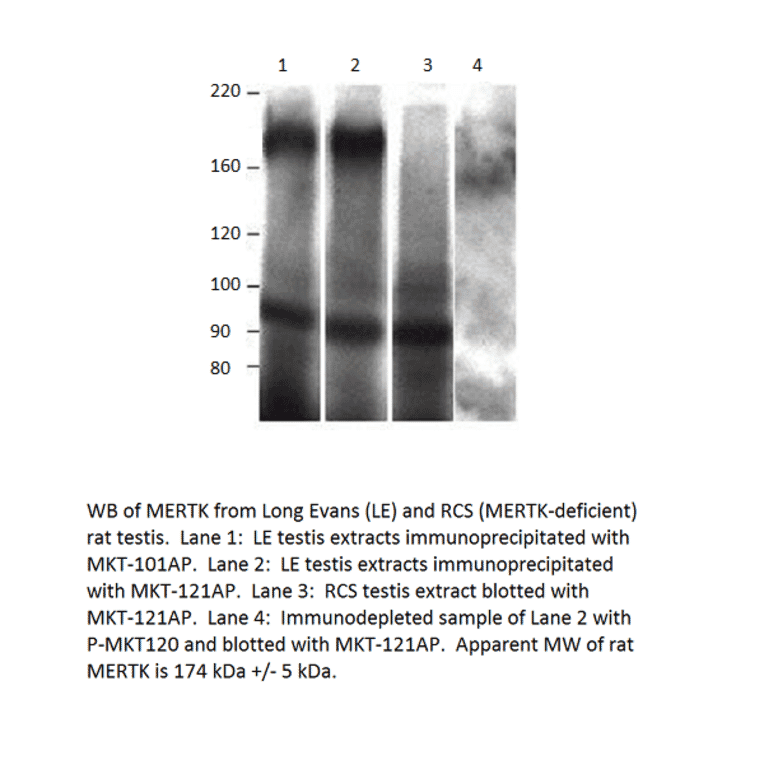 Anti-MERTK Antibody from FabGennix (MKT-101AP) - Antibodies.com