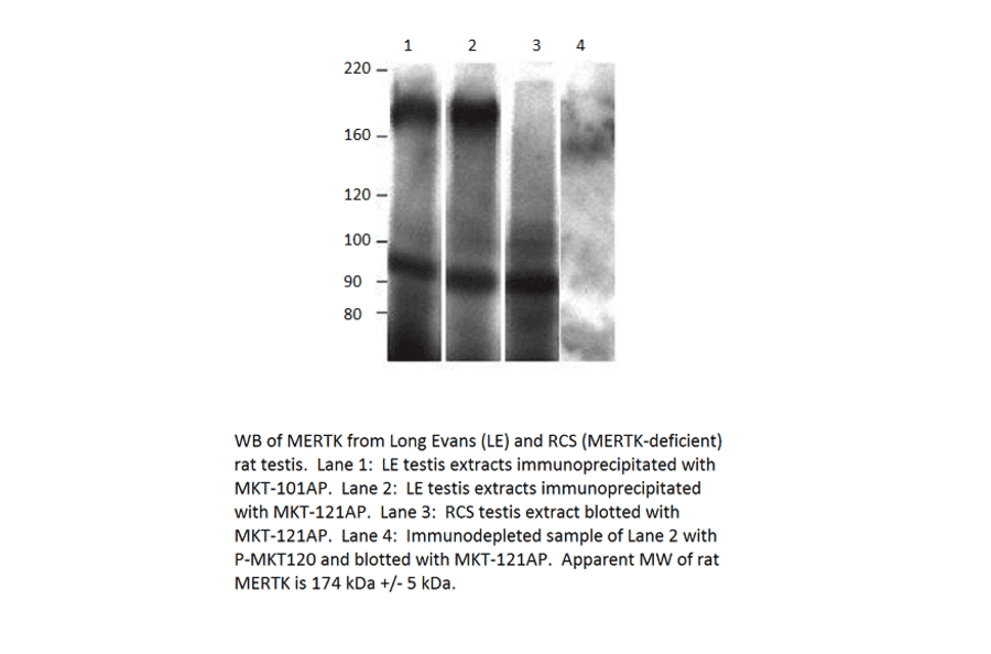 Anti-MERTK Antibody from FabGennix (MKT-112AP) - Antibodies.com