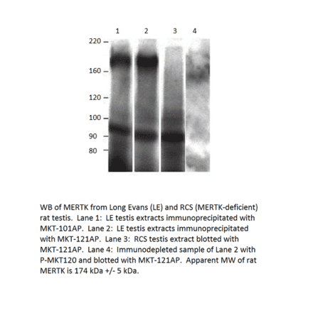 Anti-MERTK Antibody from FabGennix (MKT-112AP) - Antibodies.com