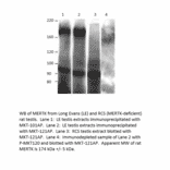 Anti-MERTK Antibody from FabGennix (MKT-112AP) - Antibodies.com