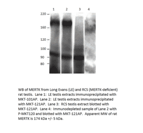 Anti-MERTK Antibody from FabGennix (MKT-121AP) - Antibodies.com