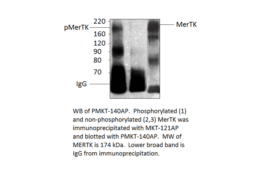 Anti-MERTK Antibody from FabGennix (MKT-121AP) - Antibodies.com