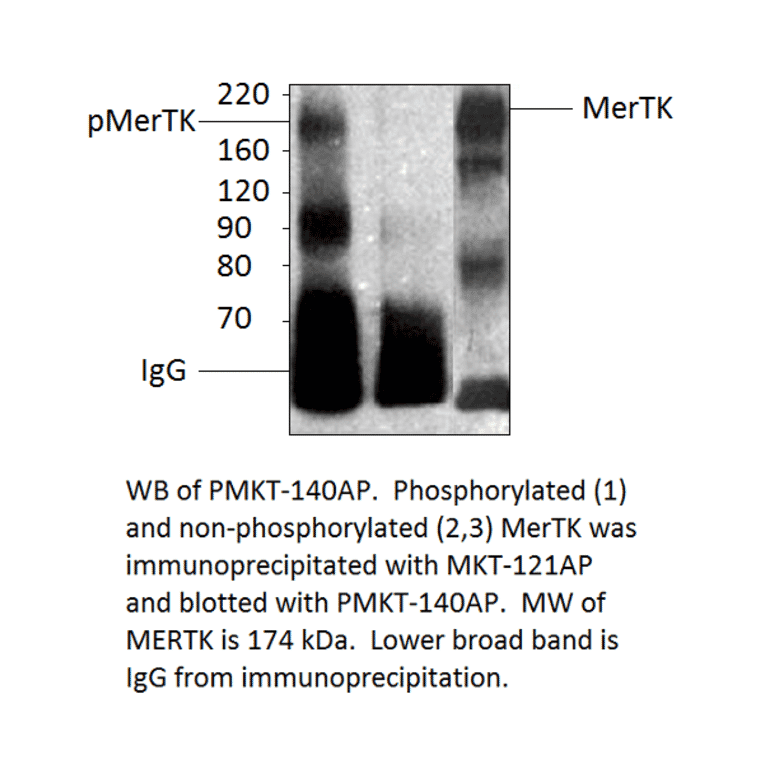 Anti-MERTK Antibody from FabGennix (MKT-121AP) - Antibodies.com