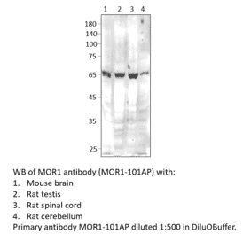 Anti-MOR1 Antibody from FabGennix (MOR1-101AP) - Antibodies.com