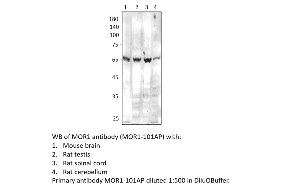 Anti-MOR1 Antibody from FabGennix (MOR1-101AP) - Antibodies.com