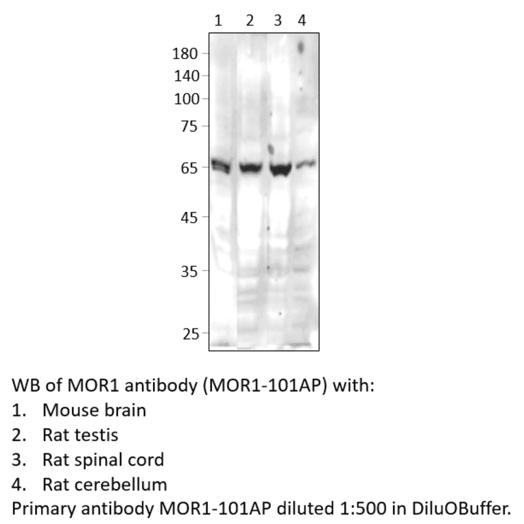Anti-MOR1 Antibody from FabGennix (MOR1-101AP) - Antibodies.com