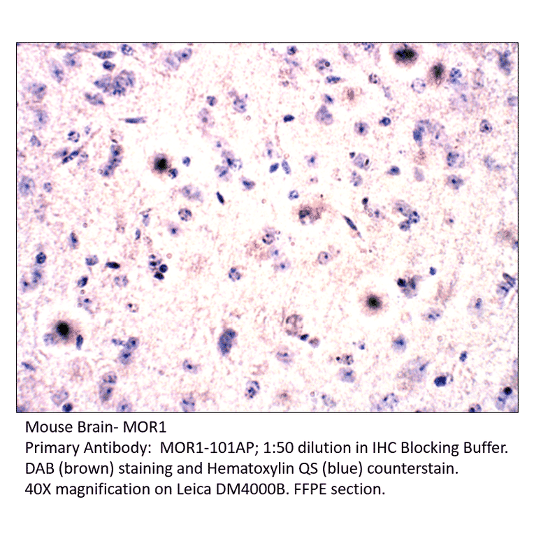 Anti-MOR1 Antibody from FabGennix (MOR1-101AP) - Antibodies.com