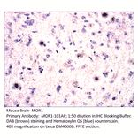 Anti-MOR1 Antibody from FabGennix (MOR1-101AP) - Antibodies.com