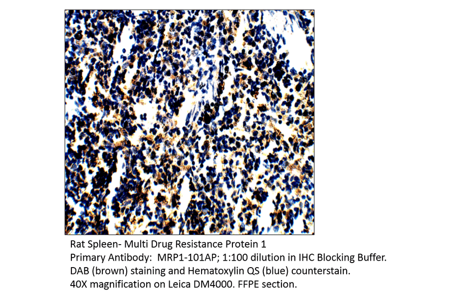 Anti-MRP1 Antibody from FabGennix (MRP1-101AP) - Antibodies.com