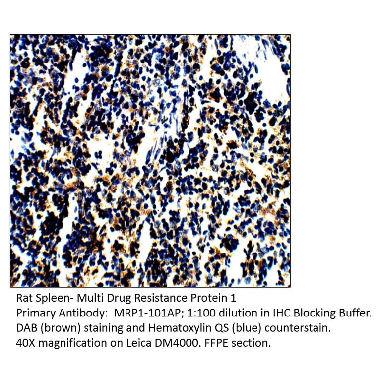 Anti-MRP1 Antibody from FabGennix (MRP1-101AP) - Antibodies.com