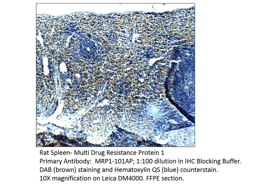 Anti-MRP1 Antibody from FabGennix (MRP1-101AP) - Antibodies.com