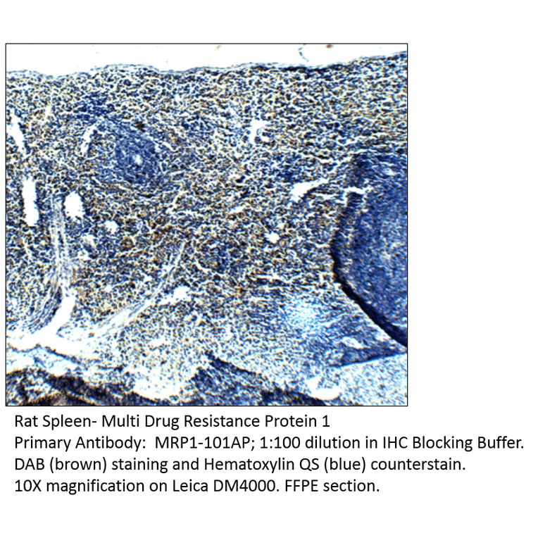 Anti-MRP1 Antibody from FabGennix (MRP1-101AP) - Antibodies.com