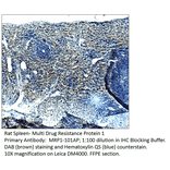 Anti-MRP1 Antibody from FabGennix (MRP1-101AP) - Antibodies.com