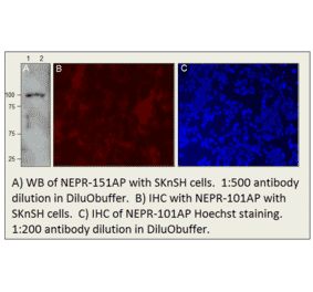 Anti-CD10 Antibody from FabGennix (NEPR-101AP) - Antibodies.com