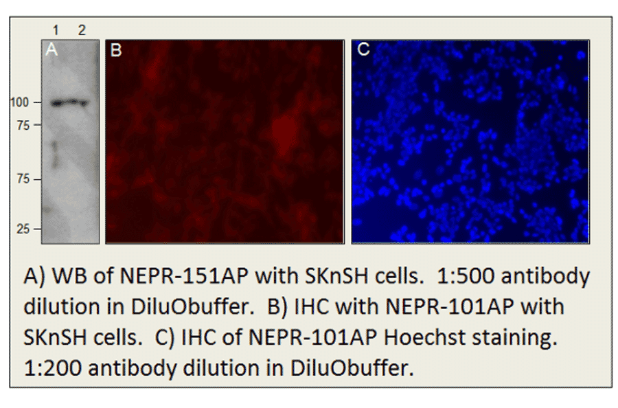 Anti-CD10 Antibody from FabGennix (NEPR-101AP) - Antibodies.com