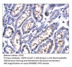 Anti-CD10 Antibody from FabGennix (NEPR-121AP) - Antibodies.com