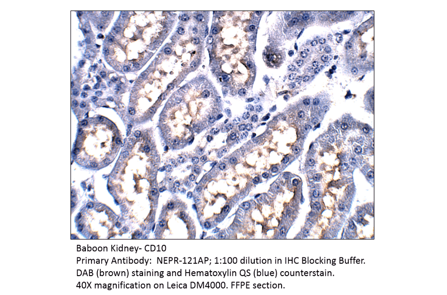 Anti-CD10 Antibody from FabGennix (NEPR-121AP) - Antibodies.com