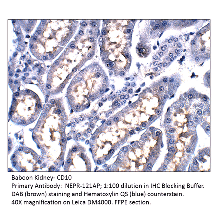 Anti-CD10 Antibody from FabGennix (NEPR-121AP) - Antibodies.com