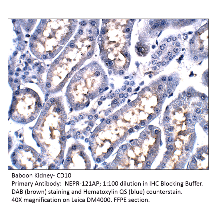 Anti-CD10 Antibody from FabGennix (NEPR-121AP) - Antibodies.com