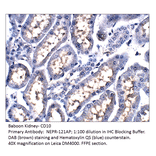 Anti-CD10 Antibody from FabGennix (NEPR-121AP) - Antibodies.com