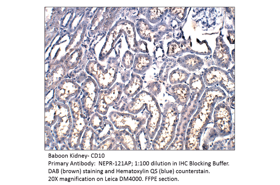 Anti-CD10 Antibody from FabGennix (NEPR-121AP) - Antibodies.com