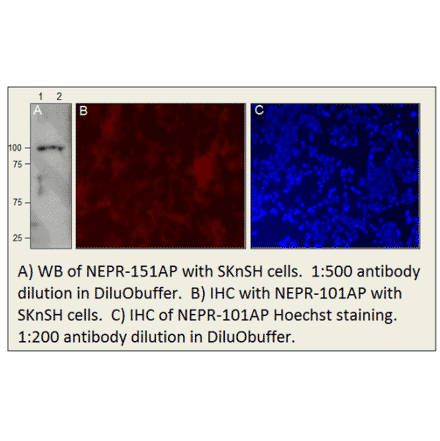 Anti-CD10 Antibody from FabGennix (NEPR-151AP) - Antibodies.com