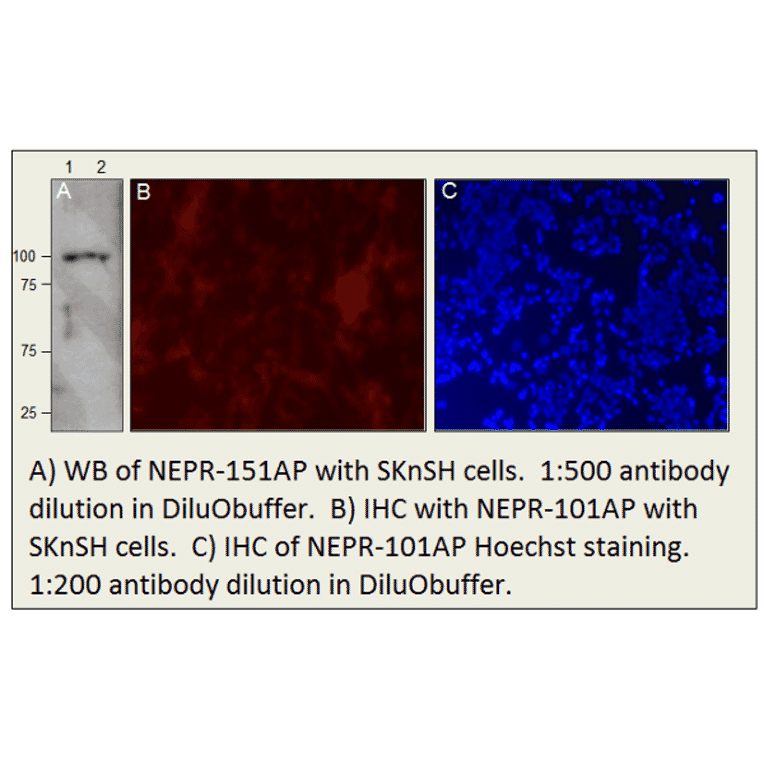 Anti-CD10 Antibody from FabGennix (NEPR-151AP) - Antibodies.com