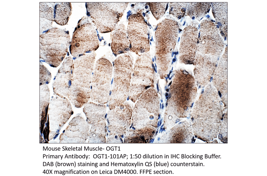 Anti-OGT1 Antibody from FabGennix (OGT1-101AP) - Antibodies.com