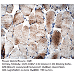 Anti-OGT1 Antibody from FabGennix (OGT1-101AP) - Antibodies.com