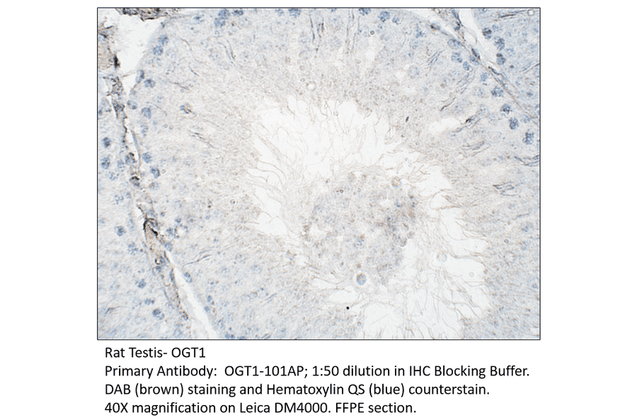Anti-OGT1 Antibody from FabGennix (OGT1-101AP) - Antibodies.com