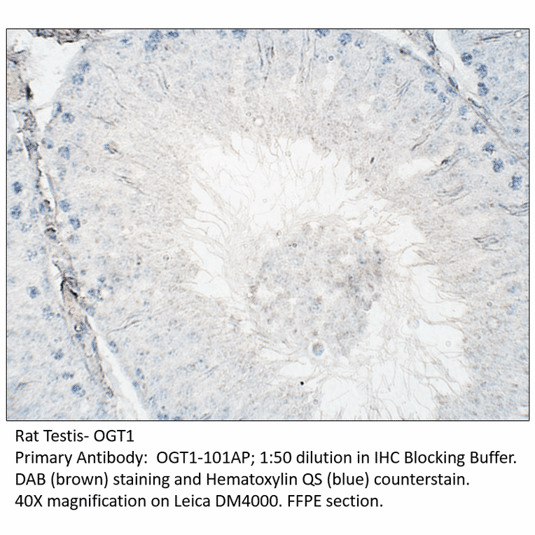 Anti-OGT1 Antibody from FabGennix (OGT1-101AP) - Antibodies.com