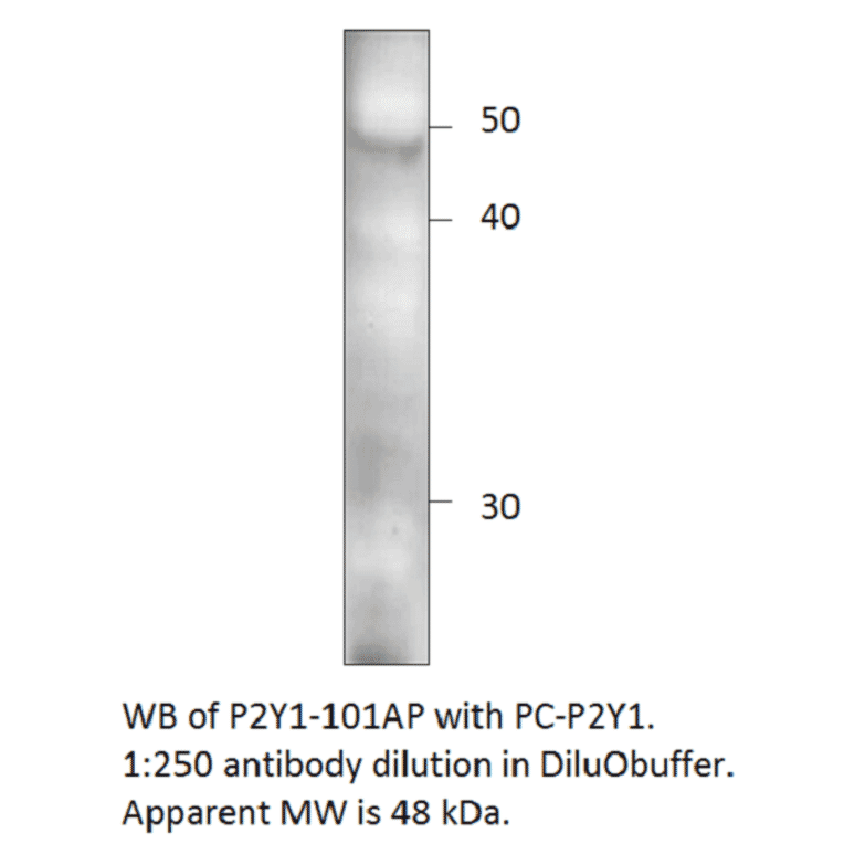 Anti-P2Y1 Antibody from FabGennix (P2Y1-101AP) - Antibodies.com