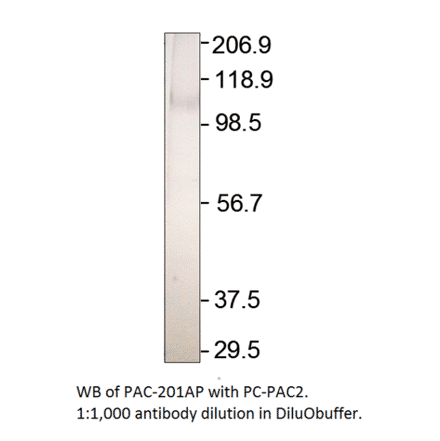Anti-ADCY2 Antibody from FabGennix (PAC-201AP) - Antibodies.com