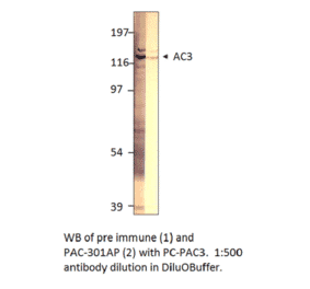 Anti-ADCY3 Antibody from FabGennix (PAC-301AP) - Antibodies.com
