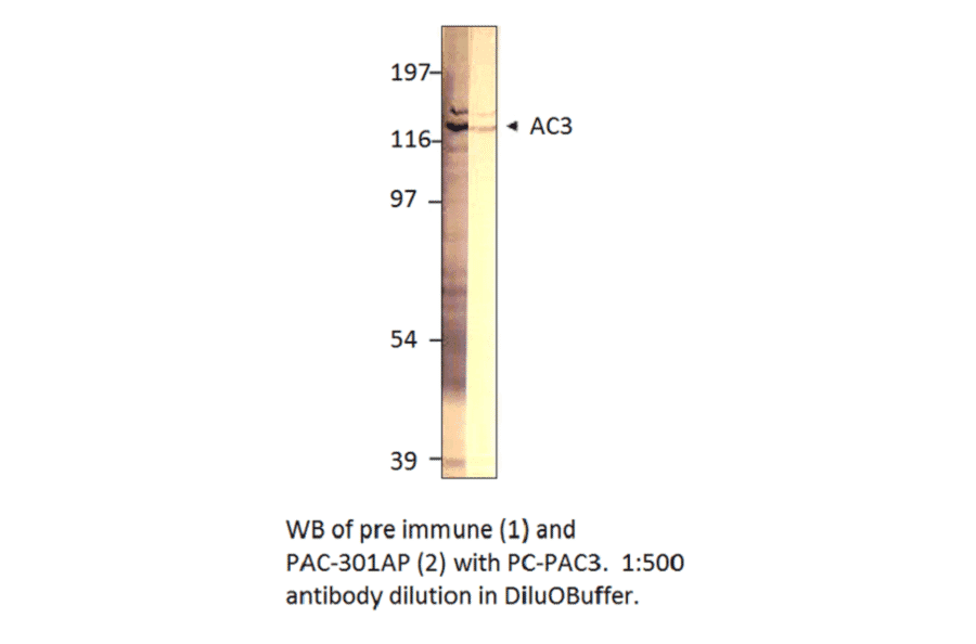 Anti-ADCY3 Antibody from FabGennix (PAC-301AP) - Antibodies.com