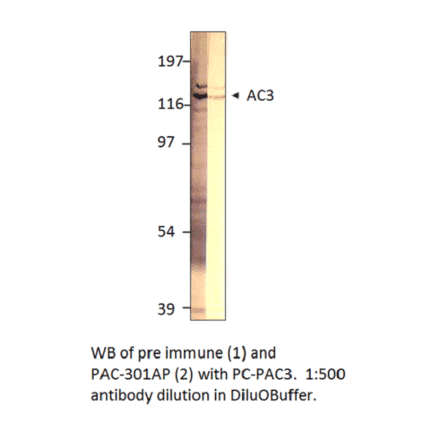 Anti-ADCY3 Antibody from FabGennix (PAC-301AP) - Antibodies.com
